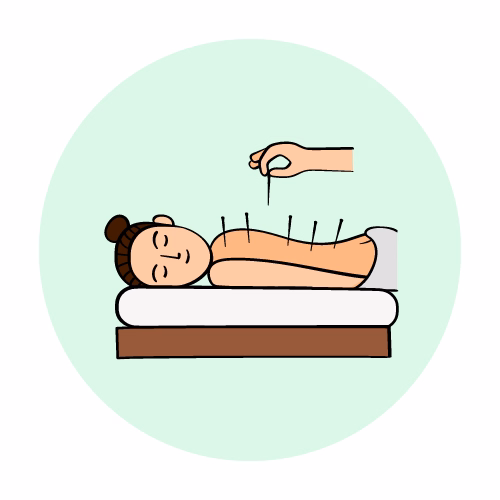 Acupuncture